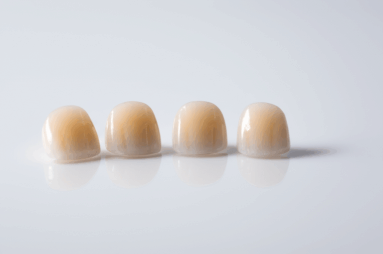 How Much Would 6 Porcelain Veneers Cost A Practical Honest Price Guide
